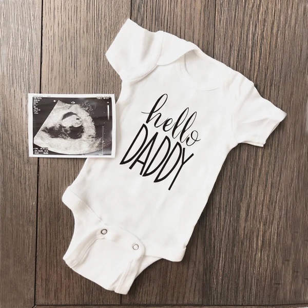 Baby Clothing Outlet - Verão bebê recém-nascido da menina do